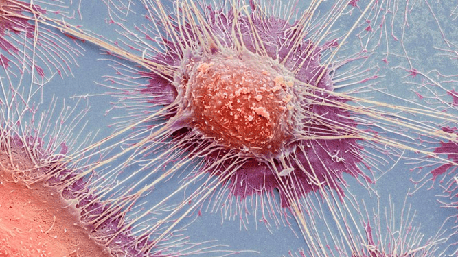 Illustration de cellule cancéreuse